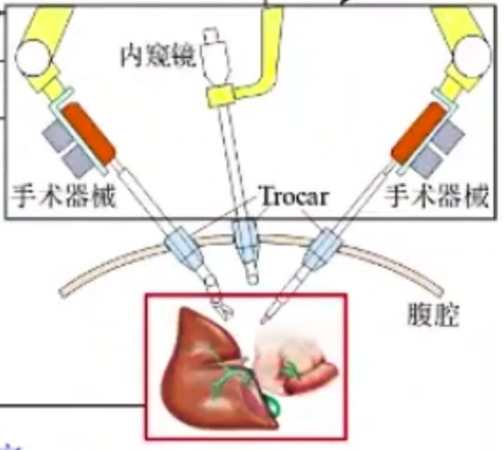 腹腔鏡手術(shù)機(jī)器人結(jié)構(gòu)設(shè)計(jì)原理—AIP艾普